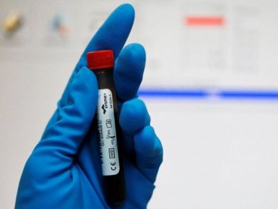 Пробы на допинг. Фото: rus.azattyq.org Пробы на допинг. Фото: rus.azattyq.org