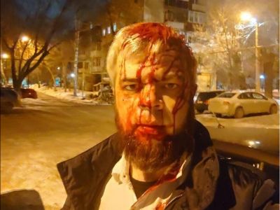 Николай Кошман после нападения на него. Фото: Валентина Волкова / Telegram